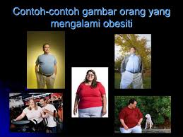 Cara mengatasi kursor hilang atau tidak terdeteksi. Ppt Masalah Obesiti Dalam Masyarakat Pada Hari Ini Powerpoint Presentation Id 5465203