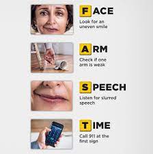 Advanced Treatment For Stroke: When Minutes Save Lives! - Northern Regional  Hospital