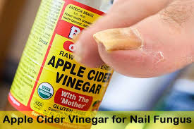 Take baking soda and sodium borate in equal amount and add water to make a paste. Home Remedies For Nail Fungus In 2020