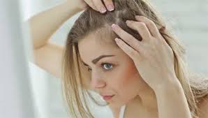 Un autre type de chute cheveux à la fois durable et localisée sur une zone précise existe. Calvitie Femme Perte De Cheveux Clinique Duquesne