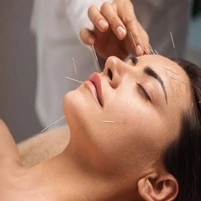 Supportive acupuncture care for post-surgery pain and stiffness in Dubai