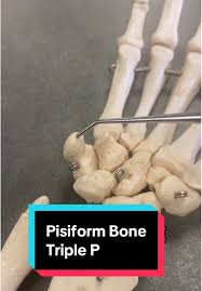Image result for Pisiform Bone