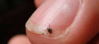 Image result for Typhus