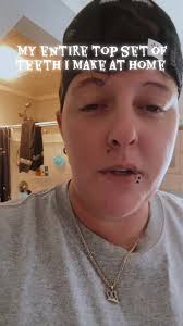 How to Make 3 Back Top Side Teeth at Home