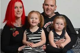 Dahulu, kehamilan kembar merupakan salah satu keuntungan secara acak apabila terdapat keluarga yang hamil kembar maka tips program hamil bayi kembar. Kembar Tapi Tak Sama Satu Sehat Satu Lagi Down Syndrome