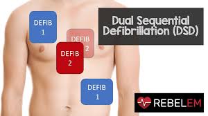 Unlike aed machine biphasic defibrillator gives bilateral current as to be positive and negative after its electrical energy is discharged. Dual Sequential Defibrillation Dsd Rebel Em Emergency Medicine Blog