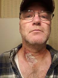 Documenting chiropractic visits for va claim success