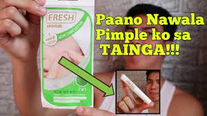 Fresh Skinlab Acne Care Lotion Review Philippines Youtube