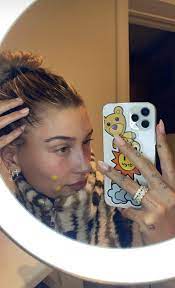 Within 24 hours of application, a white bubble will form under the bandage which shows that the healing process has begun. Hydrocolloid Bandages For Acne Are The New Tiktok Beauty Trend