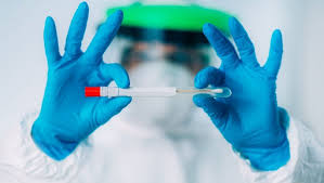 Hollanda'ya girişine izin verilen bütün yolcular, 10 gün sorunlu karantinaya tabi tutulacak. Covid 19 Test Ucreti Ne Kadar Koronavirus Pcr Test Ucreti Ve Antikor Testi Ucreti Nedir Saglik Haberleri