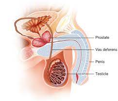 Although vasectomy reversals are possible, vasectomy should be considered a permanent form of male birth control. Vasectomy Brisbane Urology Clinic
