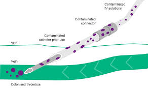 Main sources of food contamination. Microbiological Contamination