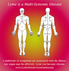 About Lyme Disease Symptoms Lyme Disease Association