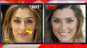 Elisa isoardi da miss italia al «si può volare anche soli. Elisa Isoardi Rifatta Dagli Esordi Ad Oggi Trattamento Estetico