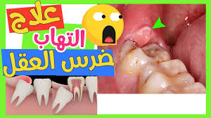 Szombat esti láz film videa / szombat esti láz fil. Ø±Ø§Ø¦Ø¯ ÙØ¶Ø§Ø¡ Ø§Ù„ÙØ¹Ù„ Ø³Ø£ÙƒÙˆÙ† Ù‚ÙˆÙŠØ§ Ø¹Ù„Ø§Ø¬ Ø§Ù„ØªÙ‡Ø§Ø¨ Ø¶Ø±Ø³ Ø§Ù„Ø¹Ù‚Ù„ ÙÙŠ Ø§Ù„Ù…Ù†Ø²Ù„ Hic Innotec Com