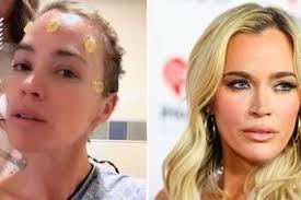 Amanda Holden Heart DJ seen for first time with leg in plaster