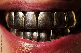 Find dentist in las vegas nv. 219 Best Gold Teeth Images Stock Photos Vectors Adobe Stock