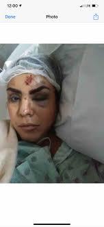 Fundraiser for Yazmine Cruz by Kari Patino : Amanda (MJ) Medical Funds and  Recovery