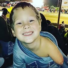 Amniotic Band Syndrome Support Page