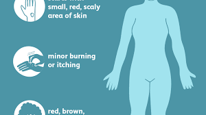 In most settings, hand washing with soap and water is generally preferred. Ringworm Signs Symptoms And Complications