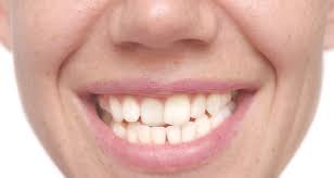 Cora Ligon, Author at Boyett Family Dentistry