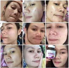 Hal ini dikarenakan bengkoang kaya akan vitamin b dan c. Collarich Collagen Original Posts Facebook