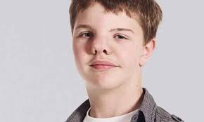 All people with facial disfigurements should be as proud as I am'