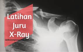 Ada lebih dari 1 juta pengguna android telah xray body scanner pro free: Latihan Juru X Ray Latihan Separa Perubatan