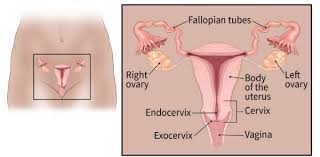 My mother has had breast cancer and my father has had colon cancer. What Is Ovarian Cancer Ovarian Tumors And Cysts