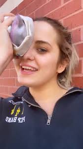 Dealing with Black Eye Injuries: Causes and Care Tips