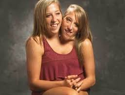 20 Interesting Things About Famous Conjoined Twins Abby And Brittany Hensel Messy Short Hair Short Hair Styles Pixie Short Hair Styles