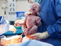 Jika anda bersalin secara pembedahan, saya kongsikan sedikit tips untuk anda amalkan semasa dalam proses berpantang. 5 Risiko Utama Pembedahan Caesarean Anda Perlu Tahu June 2021 Kelabmama Malaysia