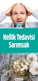 Kellik Tedavisi Icin Sarimsak Kurleri Sari Sac Bakimi Sarimsak Sac