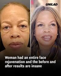 People have praised it as 'plastic surgery done right' 😯