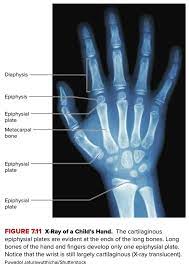 Is It Possible To Know If The Growth Plates Have Been Fused Or Not Without  An X-Ray? - Quora