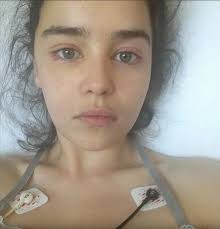 Her father was working on a theatre production of show boat and her mother took her along to the performance. Do You Know Emilia Clarke Underwent Health Struggles While Filming Got Iwmbuzz