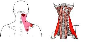Pin On Pain Relief