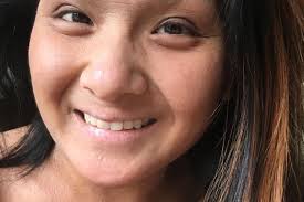 Fundraiser by Linette Roungchun : Please Help Me Get To Eczema Expo 2019!