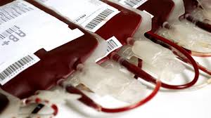 Image result for Plasma Transfusion