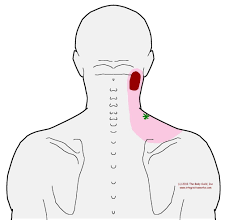 Pin On Health