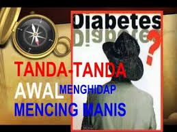 Kencing manis dan tekanan darah tinggi yang tidak terkawal juga antara punca utama kerosakan buah pinggang. Tanda Tanda Awal Kencing Manis By Zeck Zaiddy