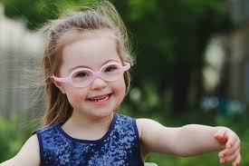 متلازمة داون أو تناذر داون أو التثالث الصبغي 21 أو التثالث الصبغي g، متلازمة صبغوية تنتج عن تغير في الكروموسومات؛ حيث توجد نسخة إضافية من كروموسوم 21 أو جزء منه في الخلايا، مما يسبب تغيراً في المورّثات. Ø§ÙØªØ´Ù Ø§Ø¹Ø±Ø§Ø¶ ÙØªÙØ§Ø²ÙØ© Ø¯Ø§ÙÙ ÙÙÙØ¨Ø§Ø± ÙØ§ÙØ§Ø·ÙØ§Ù