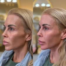 Voted Best of Monroe County @magnoliasmedspa 🤩 Thank you to everyone who  voted for us! We are truly honored to be recognized in so many categories!  I myself am so honored and