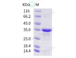 We did not find results for: Recombinant Sars Cov 2 Plpro Papain Like Protease Protein E Coli His Tag 40593 V07e Sino Biological