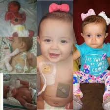 Child thriving after kidney removal surgery