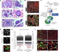 دبي، الإمارات العربية المتحدة، 28 مايو 2008: Drugs That Inhibit Tmem16 Proteins Block Sars Cov 2 Spike Induced Syncytia Nature