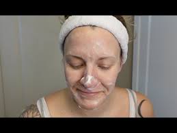 Skincare prep before electrolysis hair removal