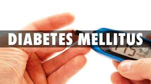 Padahal, pengertian industri sangatlah luas, yaitu menyangkut semua kegiatan manusia dalam bidang ekonomi yang sifatnya produktif dan komersial. Pengertian Diabetes Mellitus Menurut Para Ahli Ulya Days