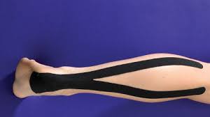 Image result for Taping for Soleus and Achilles