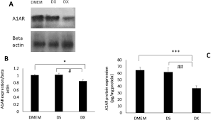 To enhance the knowledge & expertise of bumiputeras in all fields of study through professional programmes, research work and community service. Effect Of Dexamethasone On The Expression Of Mmps Adenosine A1 Receptors And Nfkb By Human Trabecular Meshwork Cells